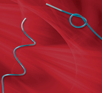 Image: The ReVerse Medical microcatheter for neurovascular indications (Photo courtesy of ReVerse Medical).